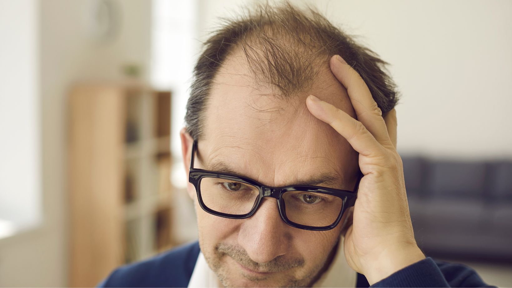 Calvície: Diga Adeus à Queda de Cabelo!