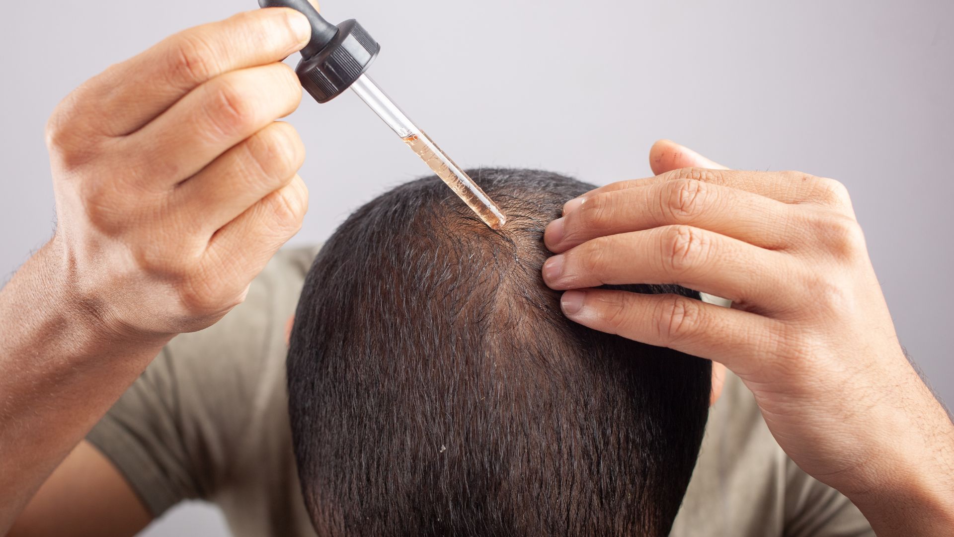 Qual a Porcentagem de Minoxidil que Funciona Melhor?